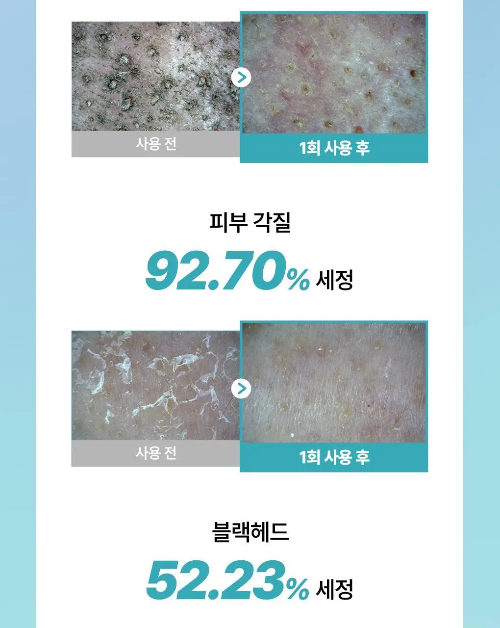 [망곰 콜라보] 일소 슈퍼 멜팅 세범 클렌징오일 200ml 기획 (+스크런치) 상세페이지 21